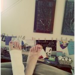 Sprained ankle